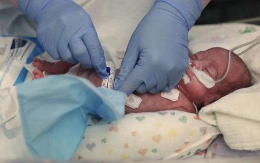 Better preemie pain relief sought amid new call for action