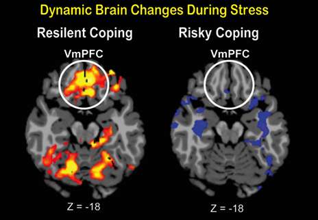 Scientists pinpoint a neural center of resilience