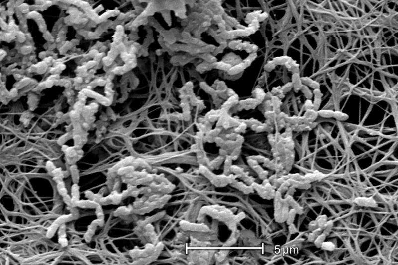 Unlocking the secrets of bacterial biofilms – to use against them