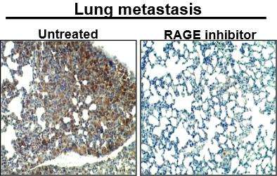 Researchers identify receptor to slow breast cancer metastasis