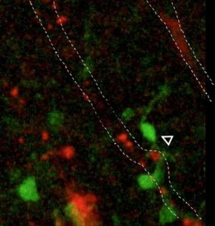 髓磷脂细胞沿血管摆动，穿过大脑
