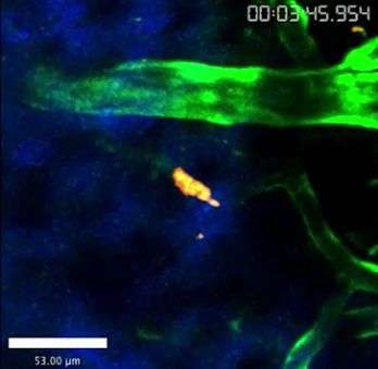 Visualizing a parasite crossing the blood brain barrier