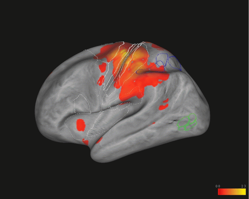 Researchers produce stunning 4D map of somatosensory processing in the brain