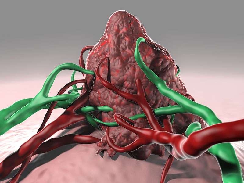 通过血液检测结肠癌脱落的DNA片段可以预测疾病的复发