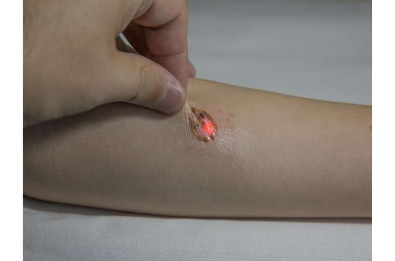 Tattoo-like skin health monitor needs no batteries