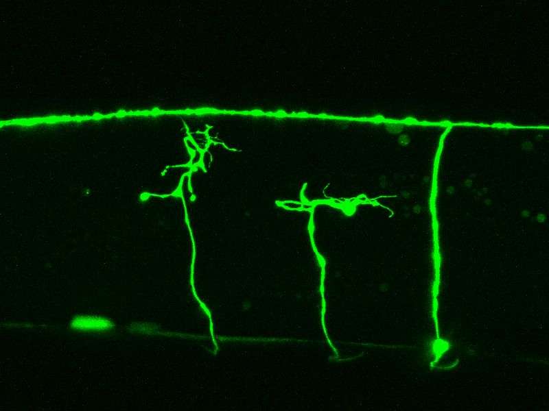 Unraveling roundworm nerve regeneration mechanism could aid nerve injury treatment