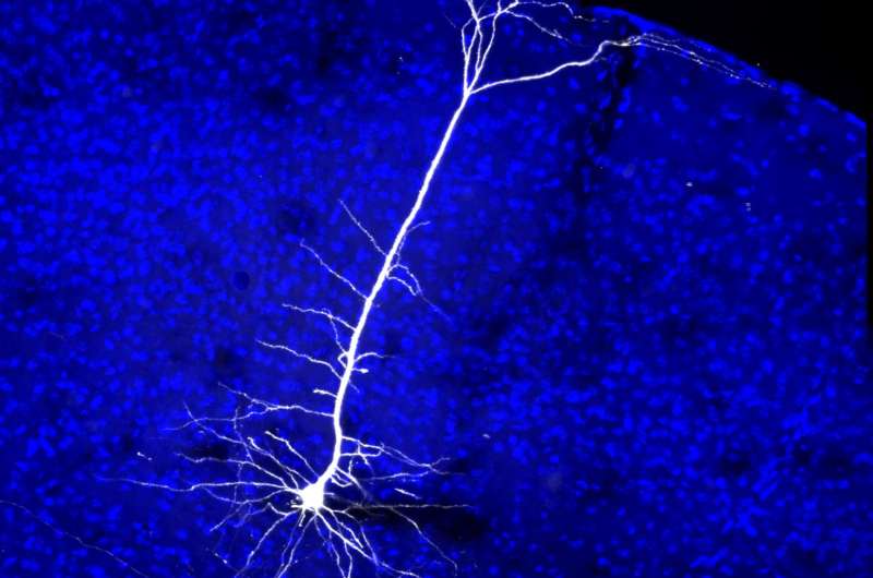 Зрительные Нейроны. Нейроны мозга. Скорость нейрона. Нейроны зрительной коры.
