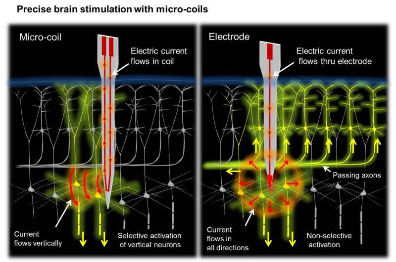 Magnetic stimulation may provide more precise, reliable activation of neural circuitry