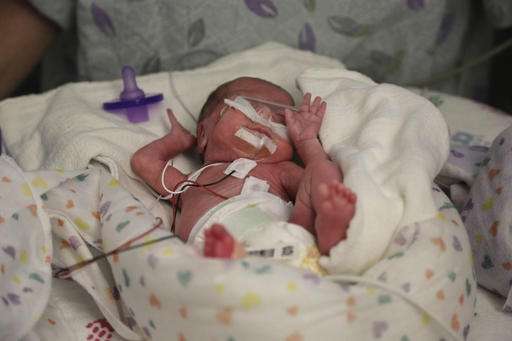 Better preemie pain relief sought amid new call for action