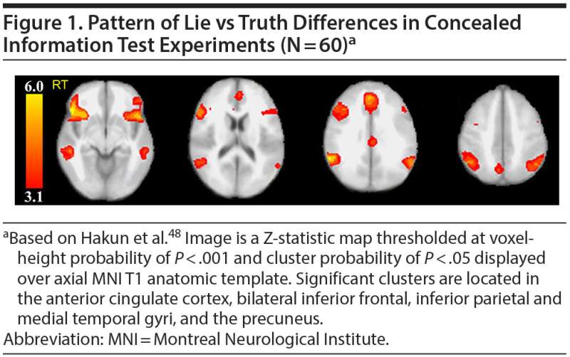 Illuminating lies with brain scan outshines polygraph test, Penn study finds