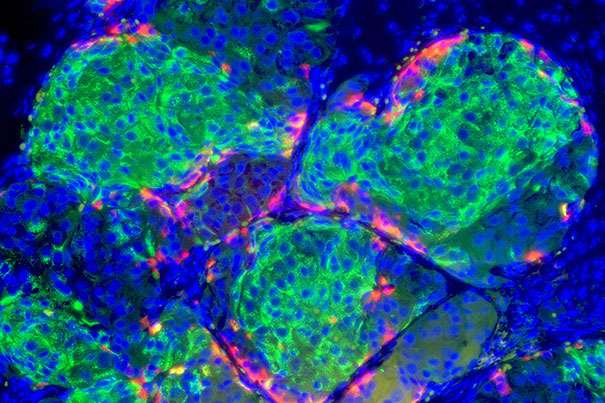 Researchers develop process to generate insulin-producing beta cells in the pancreas