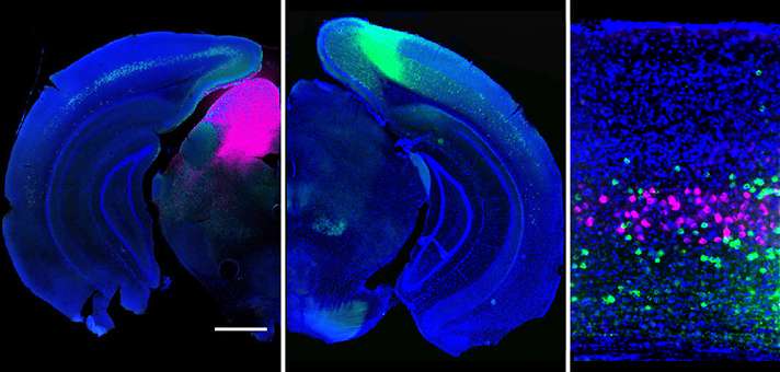 Researchers track how brain routes visual signals