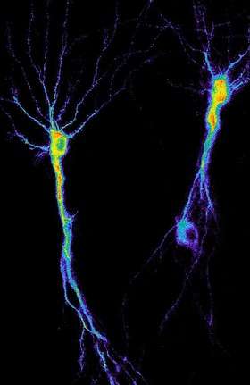 Aberrant Tau proteins put neuronal networks to sleep
