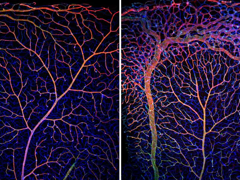 Absence of transcription factor unleashes blood vessel growth