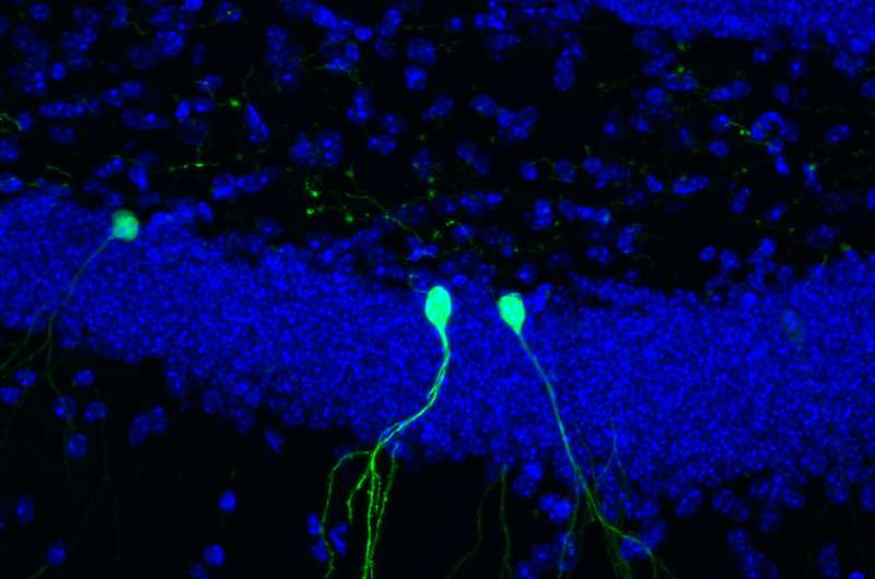 Adult brain prunes branched connections of new neurons