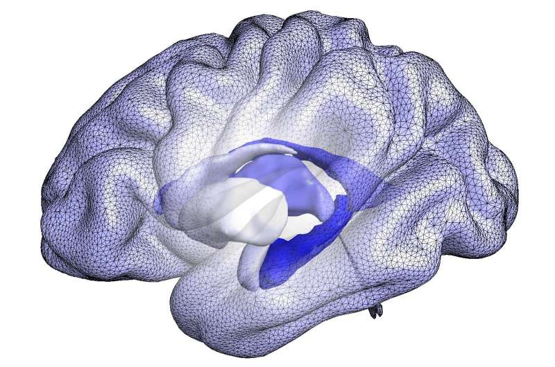 Advanced analysis of brain structure shape may track progression to Alzheimer's disease