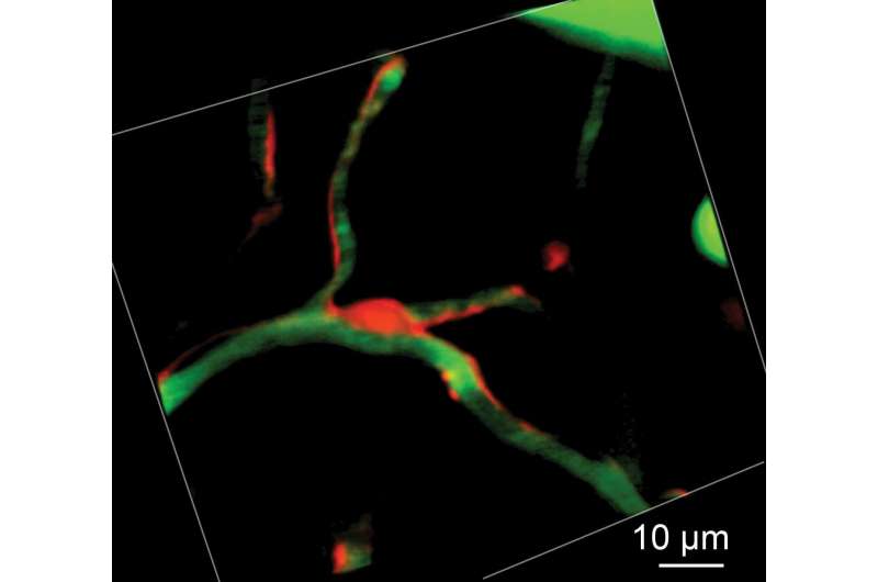 Advanced imaging of intact brains during ischemic stroke reveals a new role for pericytes