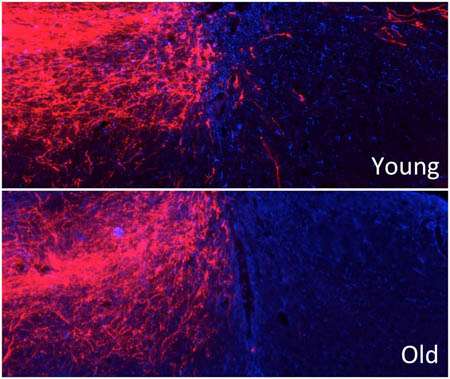 Aging diminishes spinal cord regeneration after injury