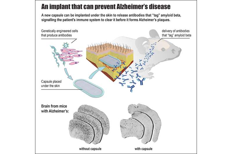 An implant to prevent Alzheimer's