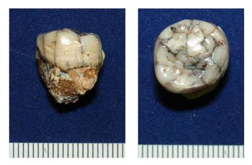 An undated picture provided by the Press Office of the Senckenberg Research Institute on January 4, 2016, shows examined tooth o