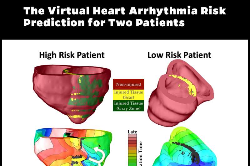 A personalized virtual heart predicts the risk of sudden cardiac death