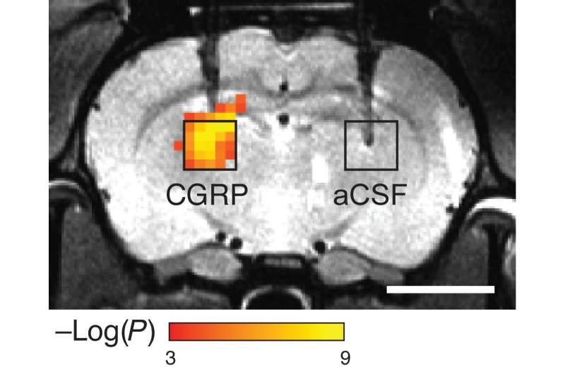 A radiation-free approach to imaging molecules in the brain