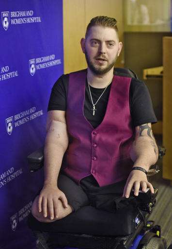 Arm transplant recipient says he can now hold fiancee's hand
