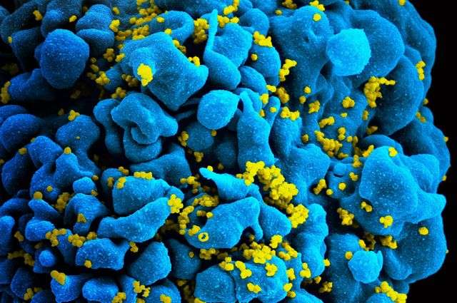 Artificial receptors kill cells infected with the virus that causes AIDS, study finds