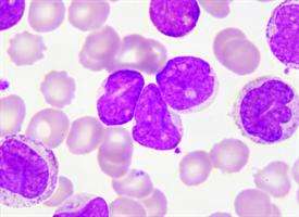 As leukemia evolves, stem cells hold keys to newer therapies