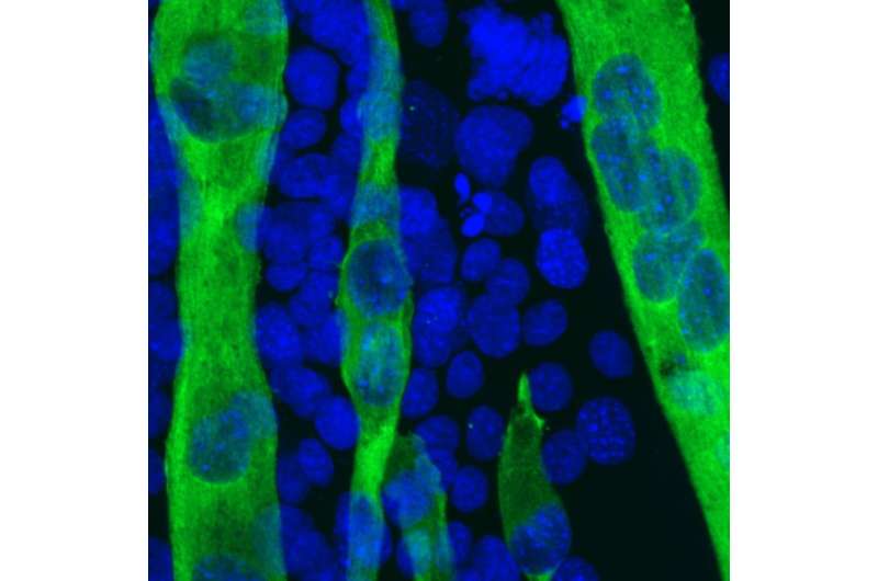 A stem cell gene found to command skeletal muscle regeneration