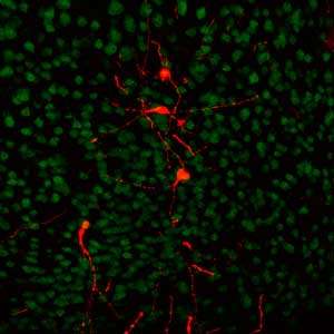 A strategy for efficiently converting stem cells to neurons offers a potent neurological research tool