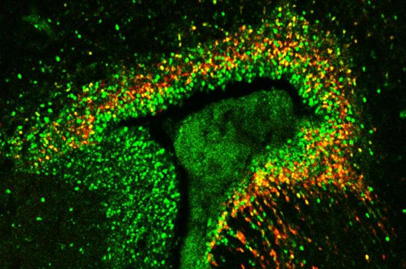 Autism-linked protein lays groundwork for healthy brain