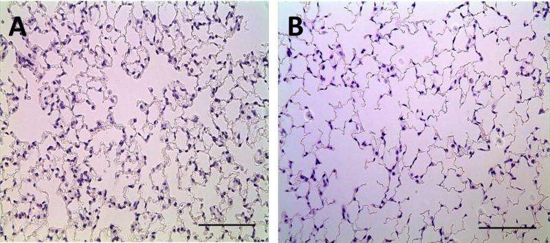 Baby's breath: A new way to study neonatal lung disease