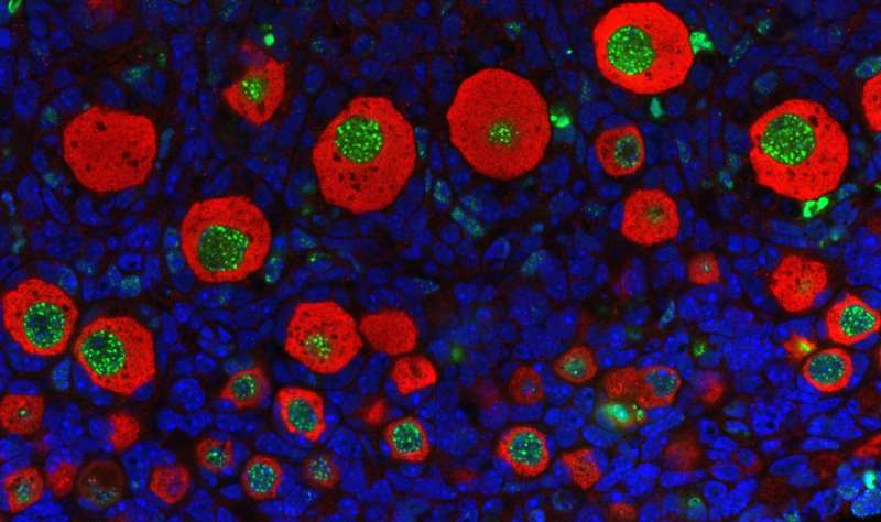 Blocking apoptotic response could preserve fertility in women receiving cancer treatments