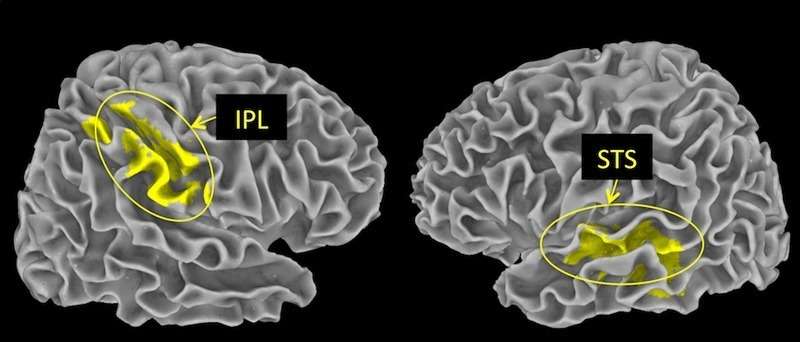 Brain areas distinguishing between good and bad