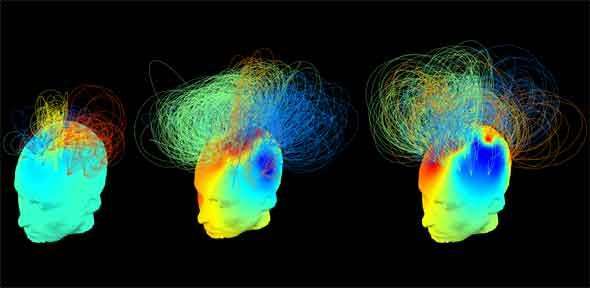 Brain, body and mind—understanding consciousness