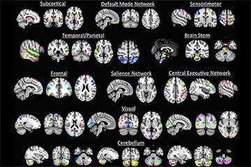 Brain pattern flexibility and behavior