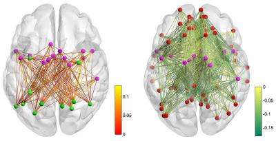 Brain scientists at TU Dresden examine brain networks during short-term task learning
