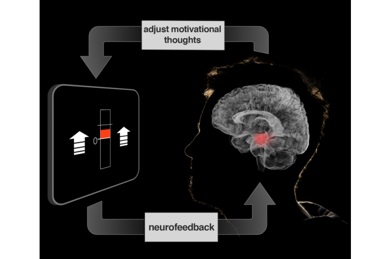 Brain tune-up may aid self-motivation