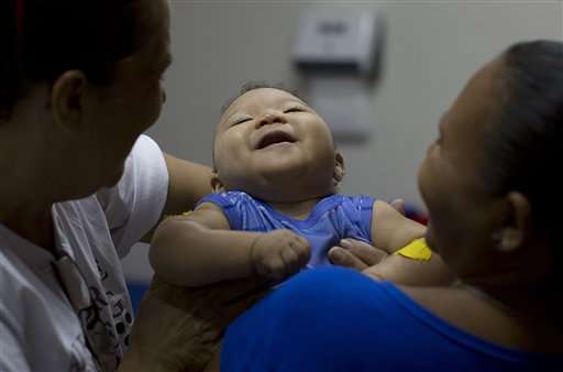 Brazil changes guidelines to determine microcephaly