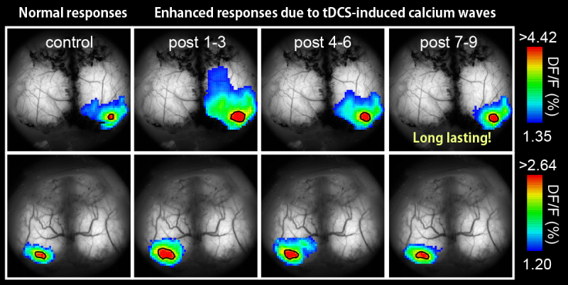 Calcium waves in the brain alleviate depressive behavior in mice