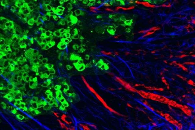 Cancer cells remodel their environment to make it easier to reach nearby blood vessels
