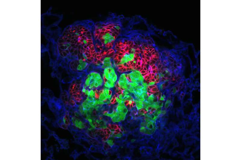 Cancer cells travel together to forge 'successful' metastases