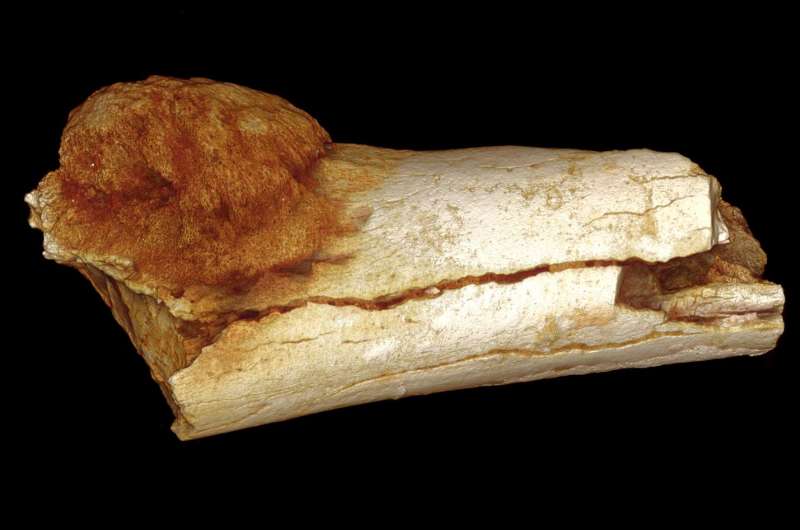 Cancer on a Paleo-diet? Ask someone who lived 1.7 million years ago