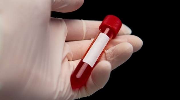 Cancers could be identified using blood tests