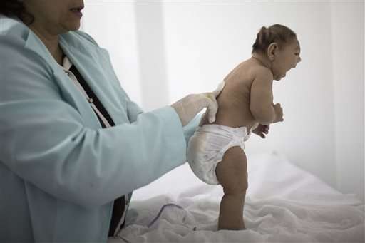 CDC: Zika definitely causes severe birth defects