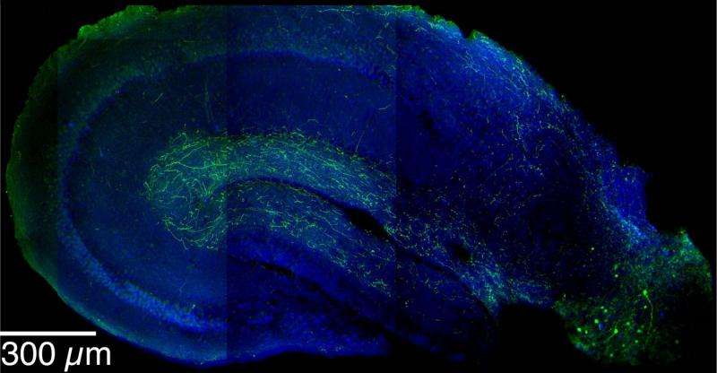 Cellular 'switch' helps brain distinguish safety from danger, new study finds