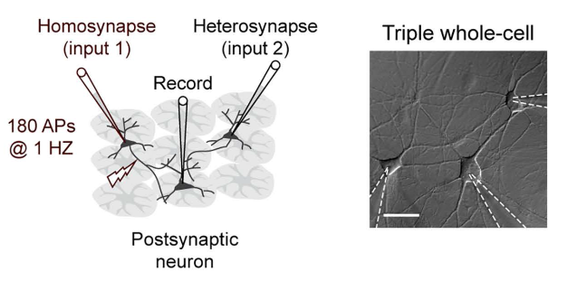 Change in the brain: Astrocytes finally getting the recognition they deserve
