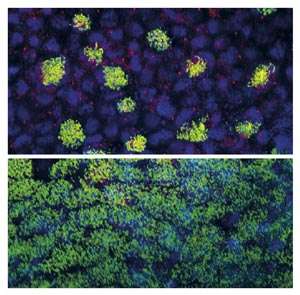 Clean sweep for lung cells