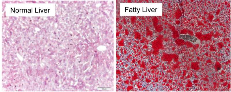 Codependence of cell nucleus proteins key to understanding fatty liver disease